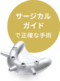 サージカルガイドで正確な手術