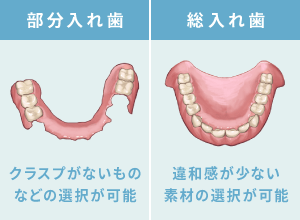 部分入れ歯：クラスプがないものなどの選択が可能、総入れ歯：金属床など様々な素材の選択が可能