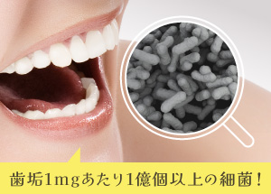 歯垢1mgあたり1億個以上の細菌！