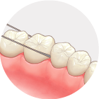 フロスで歯と歯の間まできれいにする